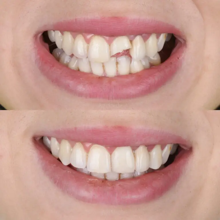 emergency dentist