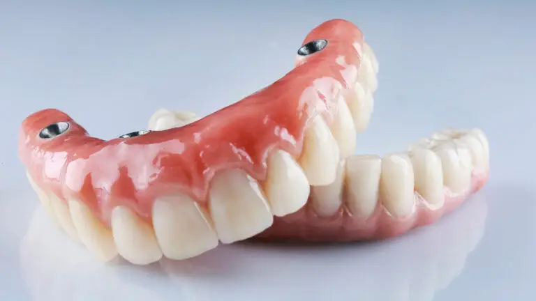 Full mouth reconstruction