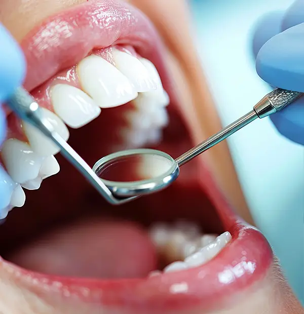 dental cleanings at a family dentistry