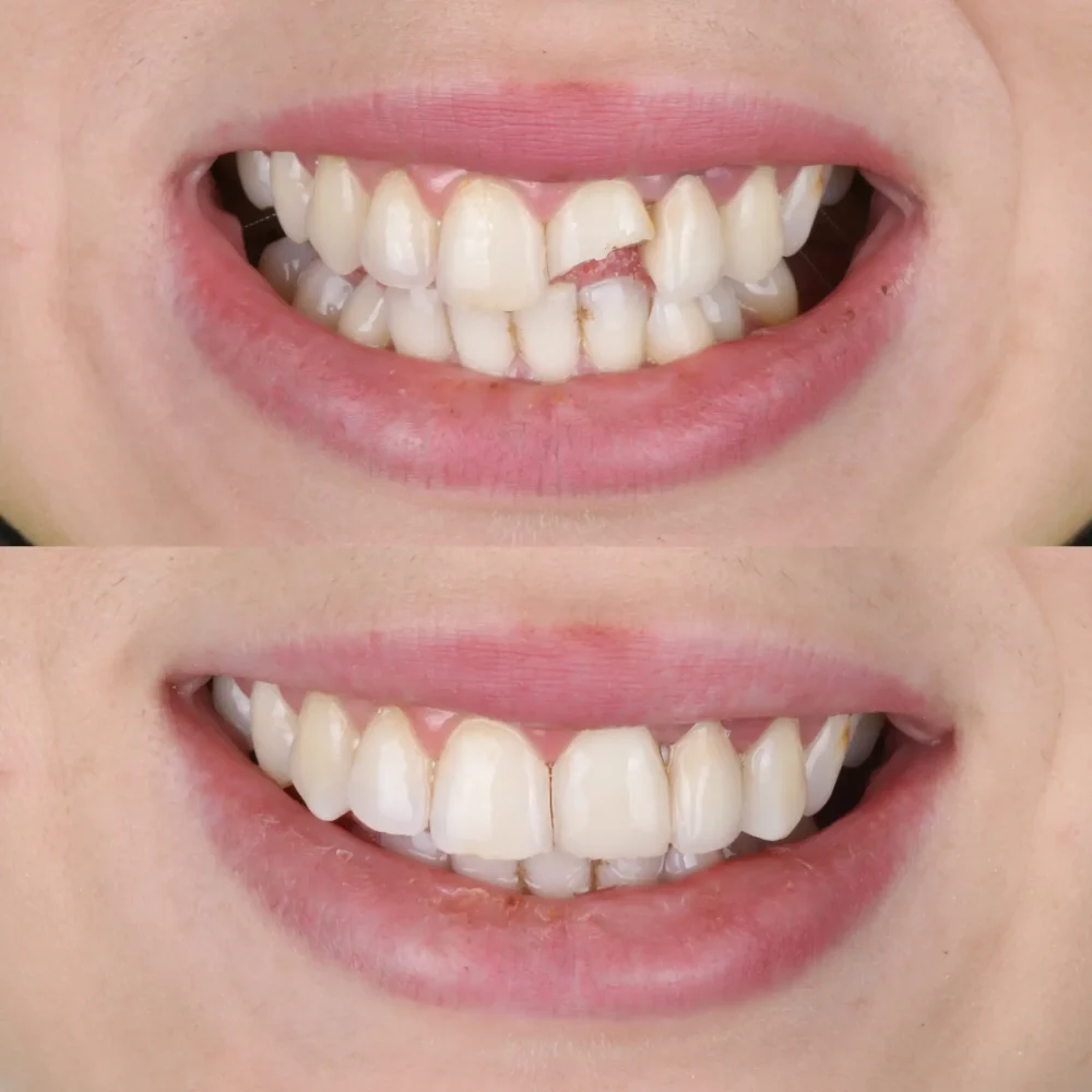emergency dentist