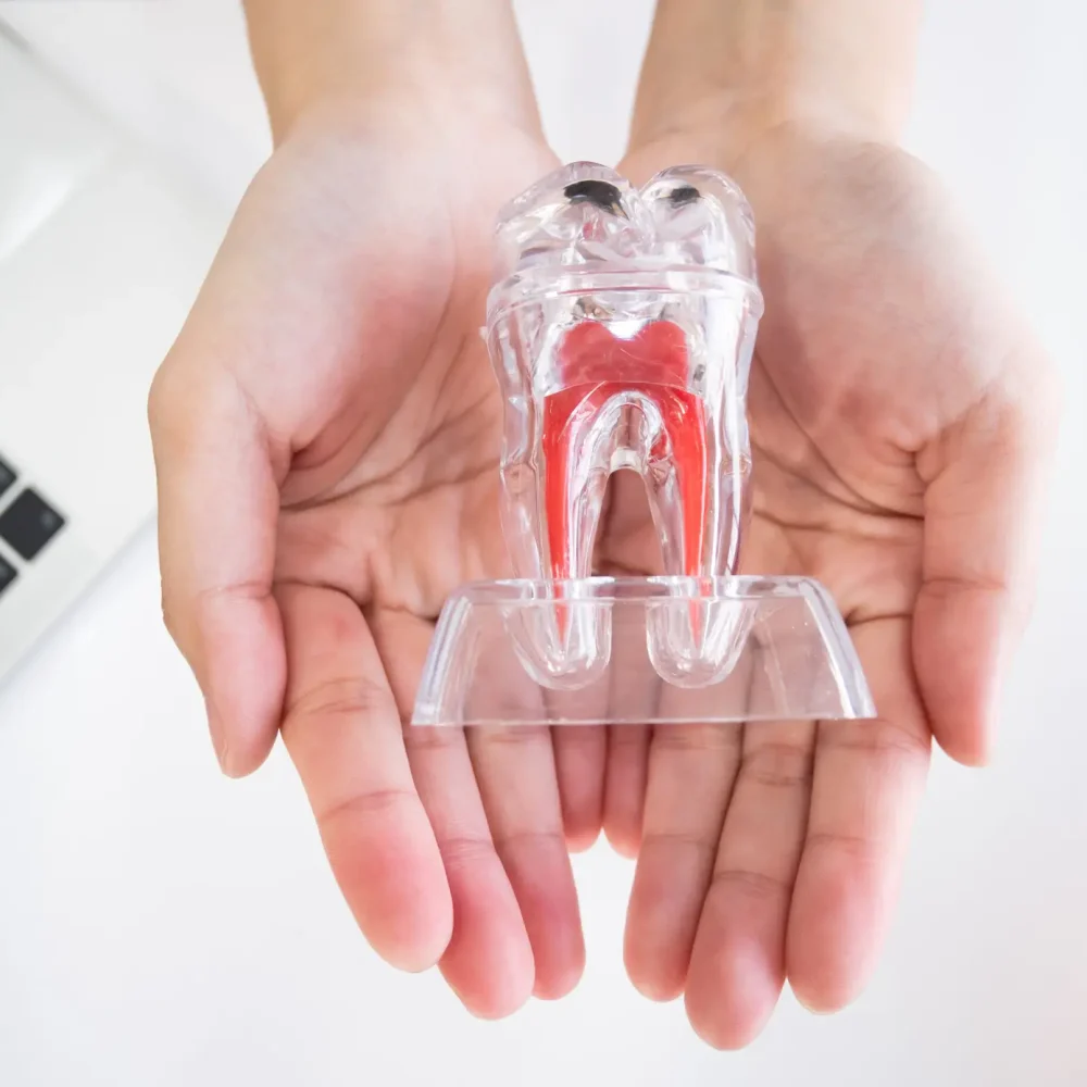 Professional dentist hold and show transparent crystal artificial red root tooth figure model ceramic material object for medical dental oral care in two palms hand for clinic and hospital explain